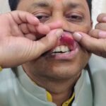 शादी समारोह में विवाद, मारपीट के बाद दो पक्ष आमने-सामने