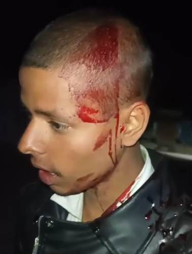 डिबुलगंज में युवक की बेरहमी से पिटाई का वीडियो वायरल, इलाके में दहशत