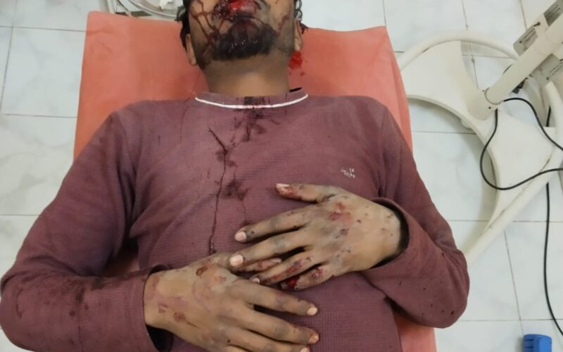 नशे में धुत बाइक सवार दो युवक गिरे,पुलिस ने पहुंचाया अस्पताल