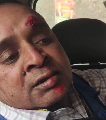 दो बाइकों की आमने-सामने टक्कर, दोनों युवक घायल