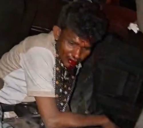 तेज रफ्तार ट्रक का कहर, दो वाहनों को टक्कर मार पलटा ट्रेलर, चालक केबिन में फंसा