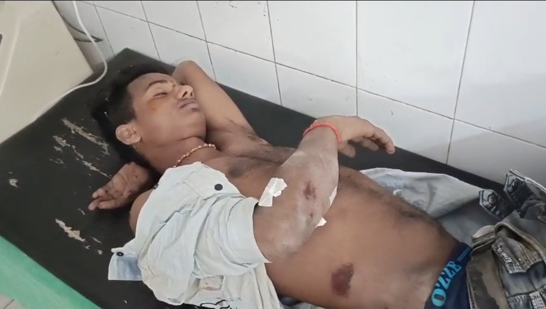 नाबालिक किशोरी को लेकर भाग रहा युवक हादसे का शिकार, हालत नाजुक